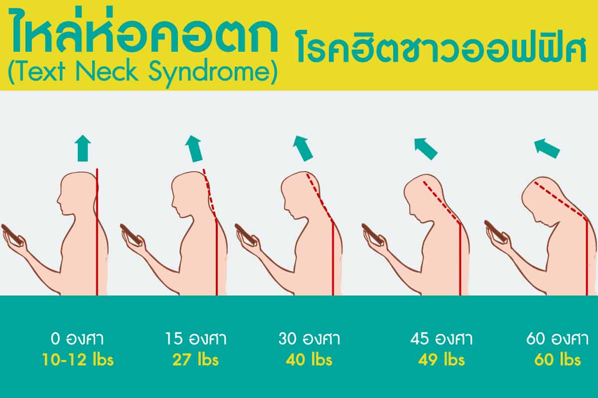 text-neck-syndrome-bewell